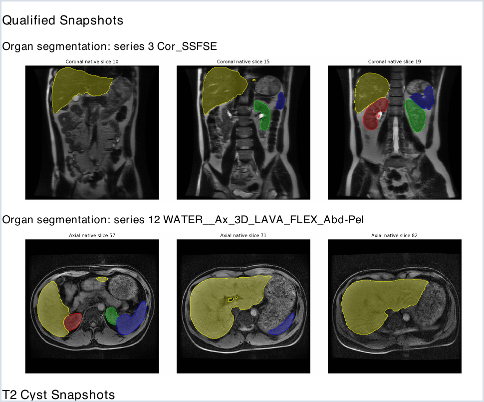 Example segmentation snapshots generated from the original imaging series.